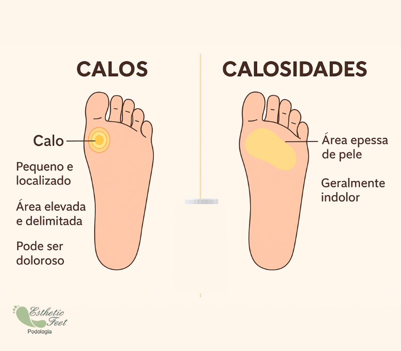 Remoção de Calos e Calosidades